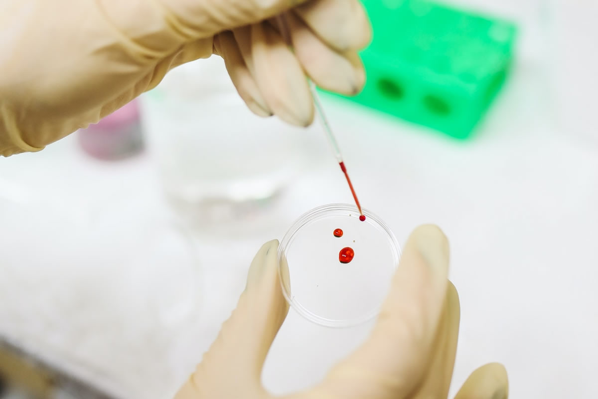 4 Tips for Making Blood Tests Easier