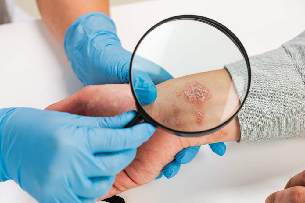 What Conditions Does a Dermatopathologist Treat?