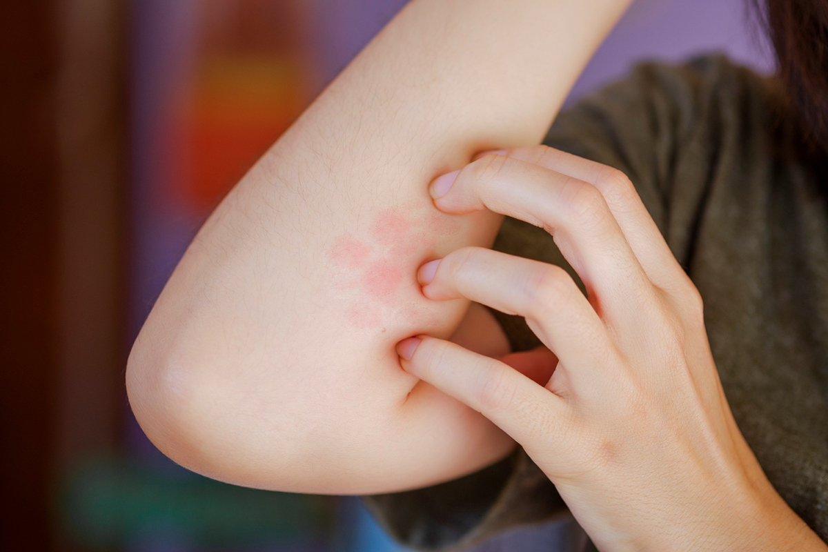 What You Need to Know About Inflammatory Skin Diseases